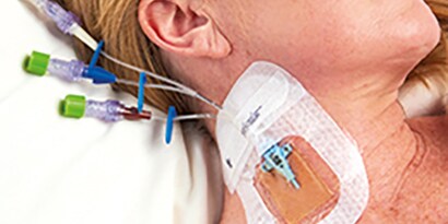 National Evidence-Based Guidelines for Preventing Healthcare-Associated Infections -ohjeistus
