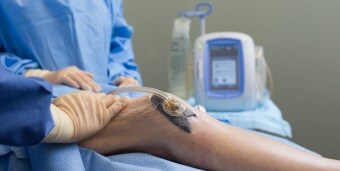 Patient knee with negtive pressure wound therapy
