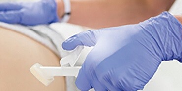 Cavilon™ Advanced ihonsuojakalvoa käytetään potilaalla
